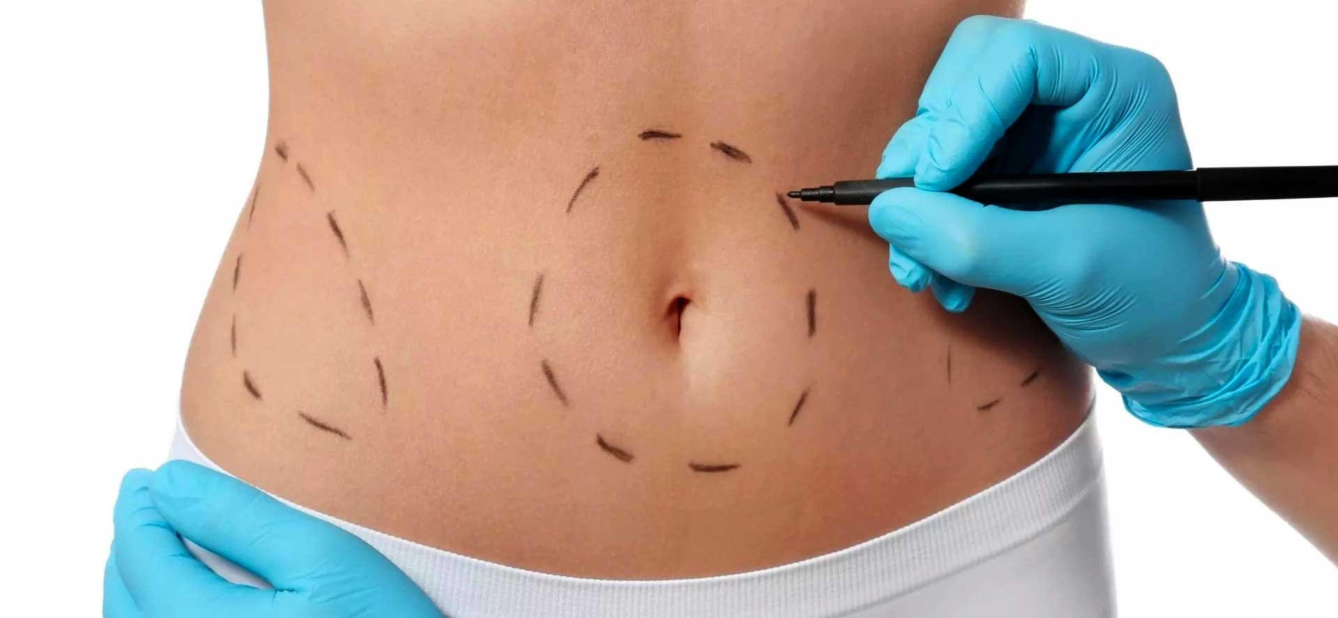 Consulenza Chirurgia Estetica