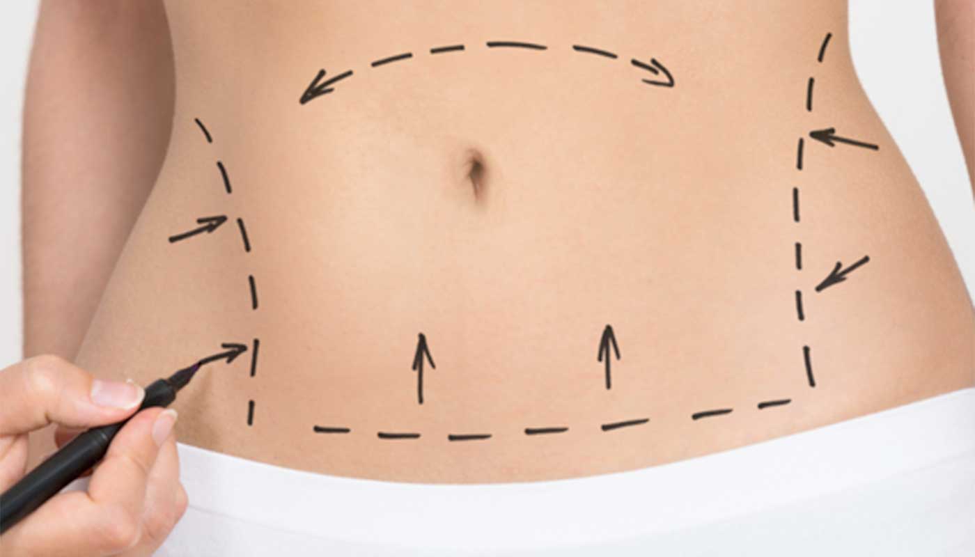 Consulenza Chirurgia Estetica